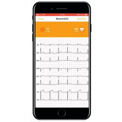 ECG Connecté